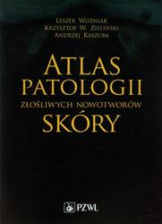 Atlas patologii złośliwych nowotworów skóry  Woźniak Zieliński Kaszuba
