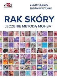 Rak skóry Leczenie metodą Mohsa Bieniek Woźniak EDRA książka medyczna