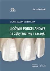 Licówki porcelanowe na zęby żuchwy i szczęki Ciesielski J. EDRA