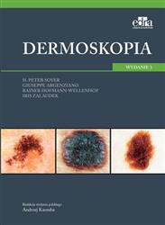 Dermoskopia Soyer H.P. , Argenziano G. , Hofmann-Wellenhof R. , Zalaudek I.