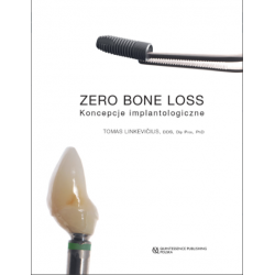 Zero Bone Loss - Koncepcje Implantologiczne - Książka Stomatologia
