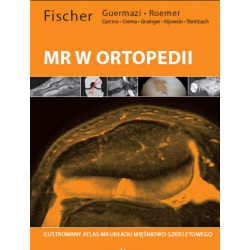 Atlas diagnostyki MR w Ortopedii Fischer, radiologia, ultrasonografia