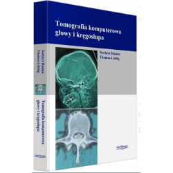 Tomografia Komputerowa Głowy i Kręgosłupa, Ultrasonografia, radiologia
