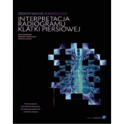 Odkrywanie Radiologii - Interpretacja Radiogramu Klatki Piersiowej