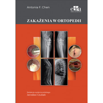 Zakażenia w Ortopedii Antonia F. Chen - Książka Ortopedyczna