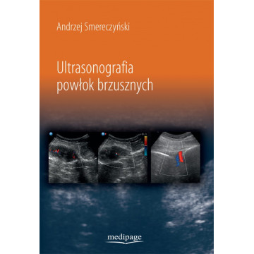 Ultrasonografia Powłok Brzusznych Andrzej Smereczyński