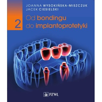 Od Bondingu Do Implantoprotetyki Tom 2 Joanna Wysokińska-Miszczuk