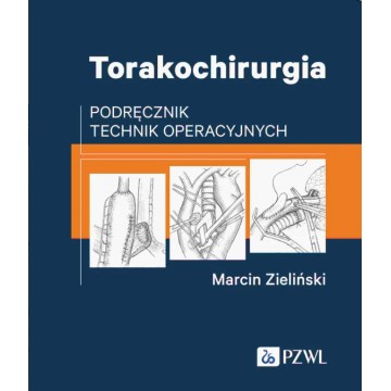 Torakochirurgia Podręcznik Technik Operacyjnych Marcin Zieliński
