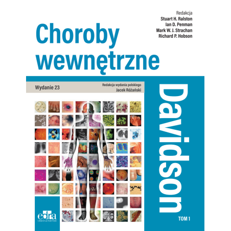 Davidson Choroby wewnętrzne Tom 1 - Książka Medyczna EDRA URBAN