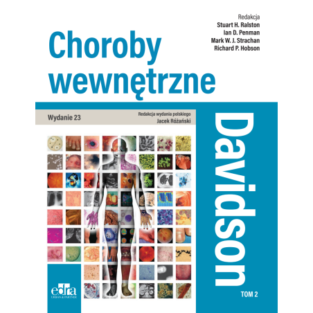 Davidson Choroby wewnętrzne Tom 2 Interna choroby wewnętrzne EDRA