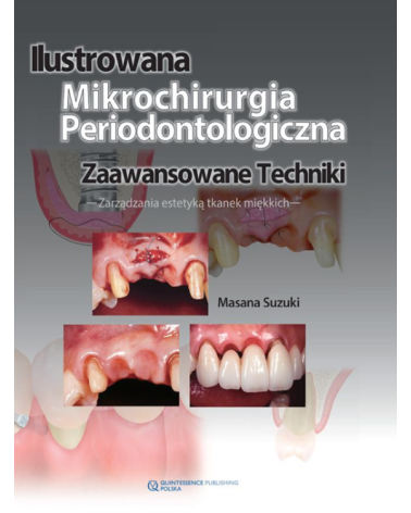 Ilustrowana Mikrochirurgia Periodontologiczna Zaawansowane Techniki