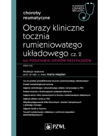 Obrazy Kliniczne Tocznia Rumieniowatego Układowego Część 2 Na Podstawie Opisów Przypadków