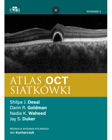 Atlas OCT Siatkówki J. S. Duker, D. Goldman, N. K. Waheed,