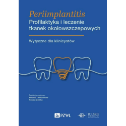 Periimplantitis Profilaktyka i Leczenie Tkanek Okołowszczepowych