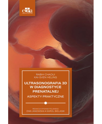 Ultrasonografia 3D w Diagnostyce Prenatalnej Aspekty Praktycznej